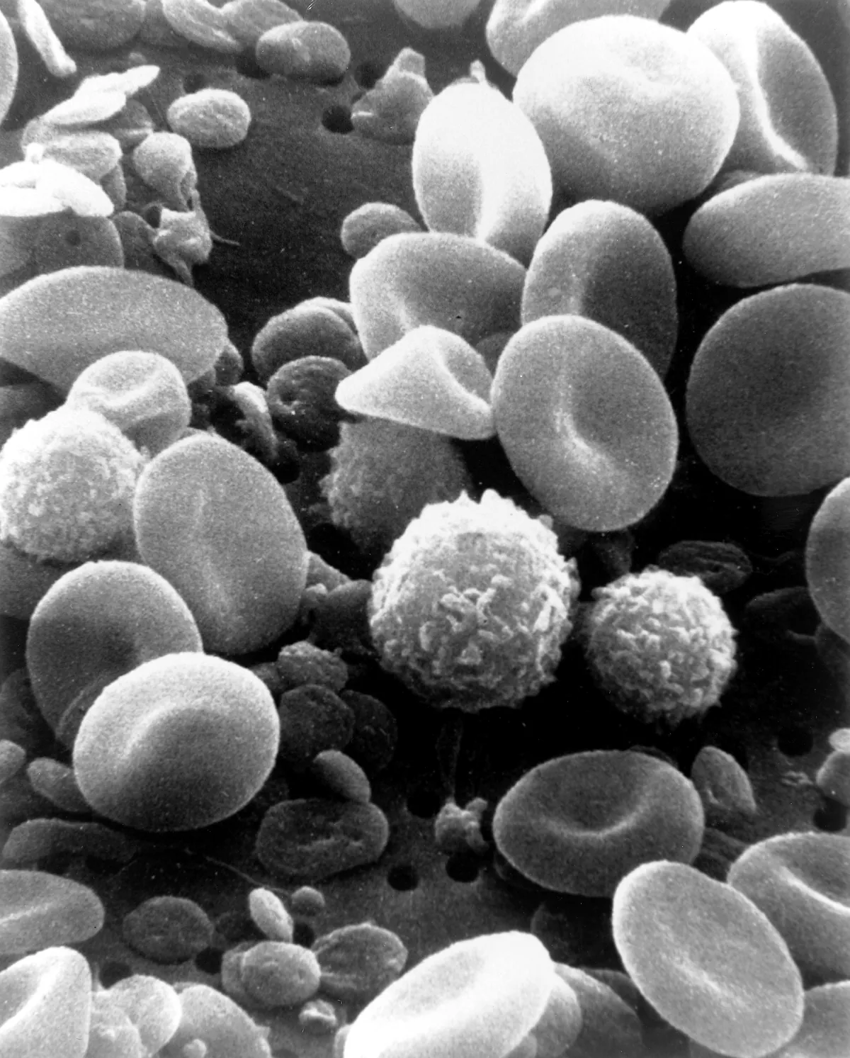Red and white blood cells under a microscope