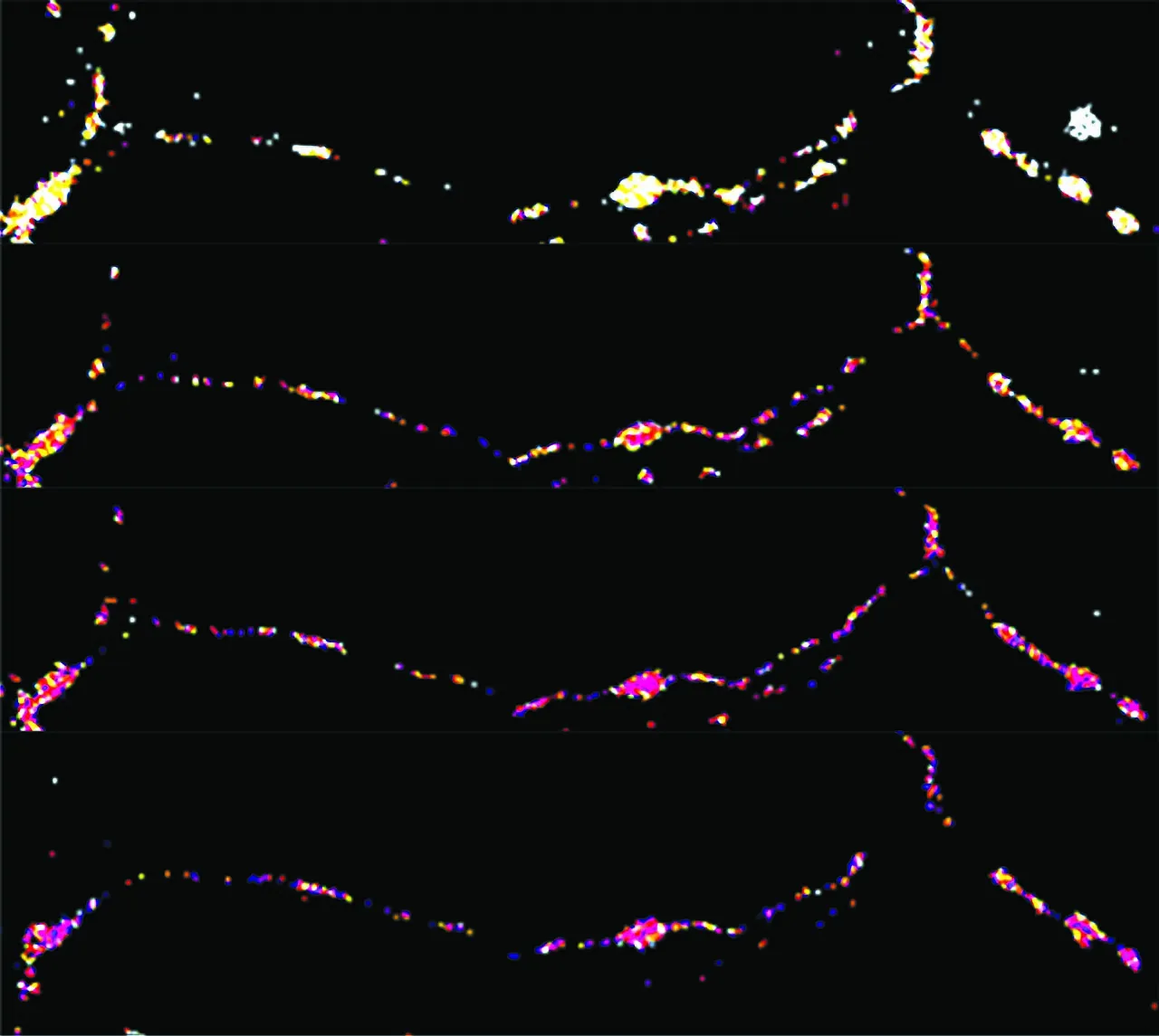 Microscope image of brain cells (neurons) from a study of how neurons use energy as they signal each other