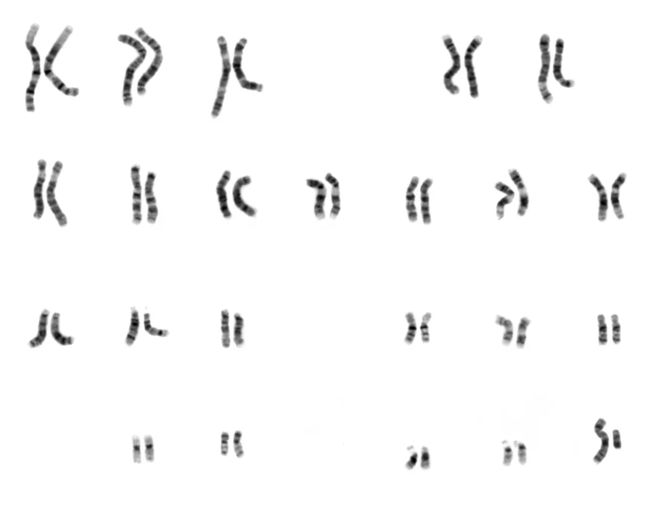 Human male karyotype: 22 numbered pairs of banded chromosomes lined up in order, plus one X and one smaller Y chromosome