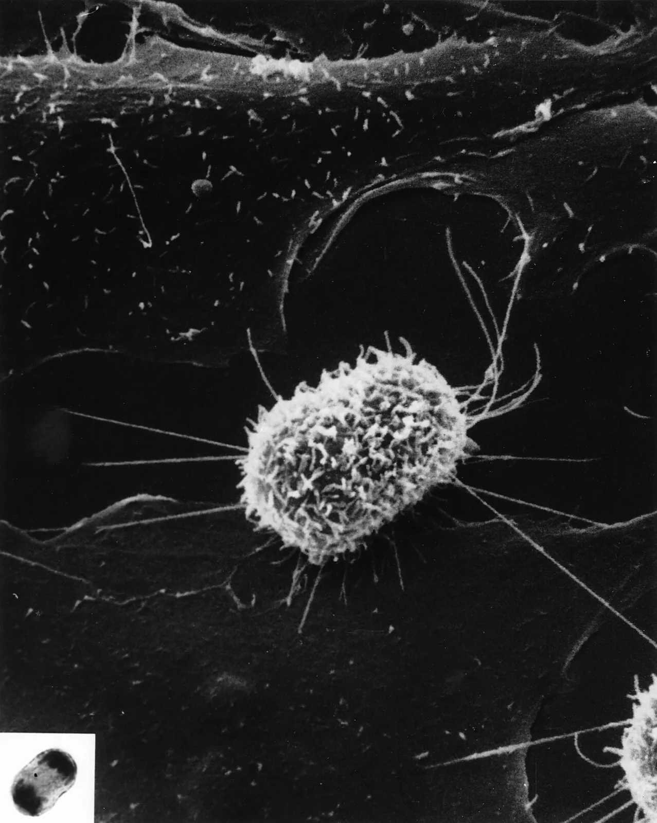 Electron microscope image of one cell pinching into two, with a small inset light-microscope view of its chromosomes pulling apart to opposite ends