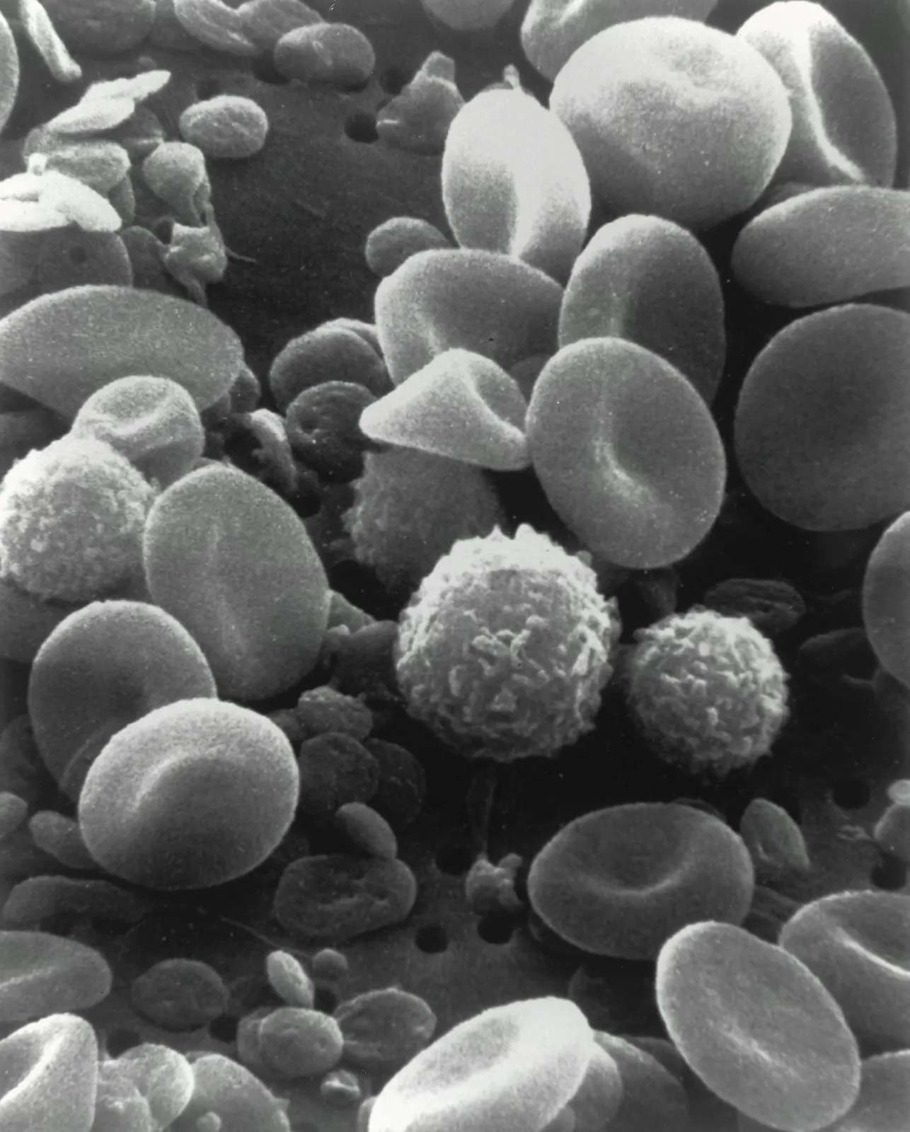 Scanning electron microscope image of human blood showing disc-shaped red blood cells, a round bumpy white blood cell and small platelets