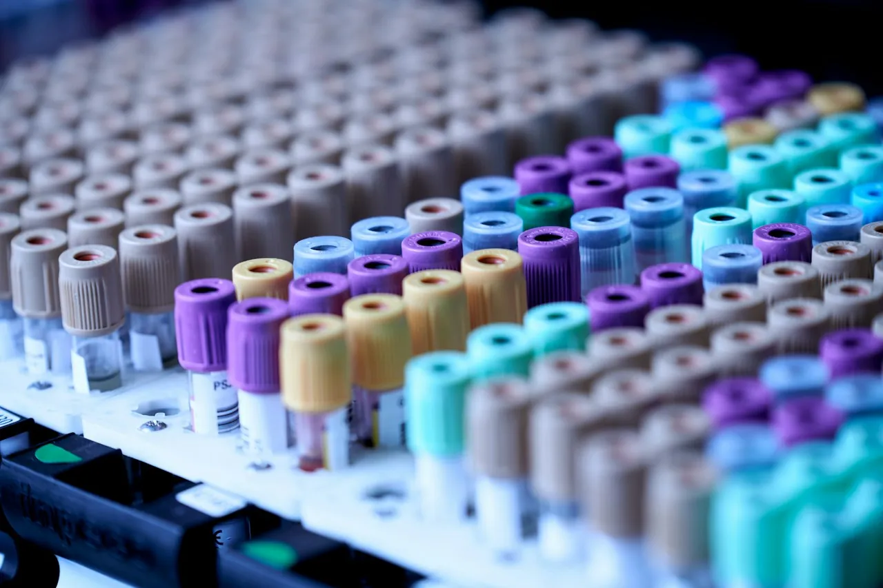 Rows of blood test tubes with colored caps in a lab rack
