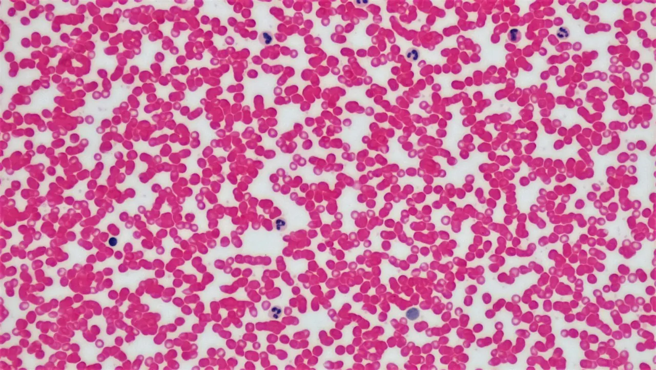 Red blood cells and a few white blood cells under a microscope