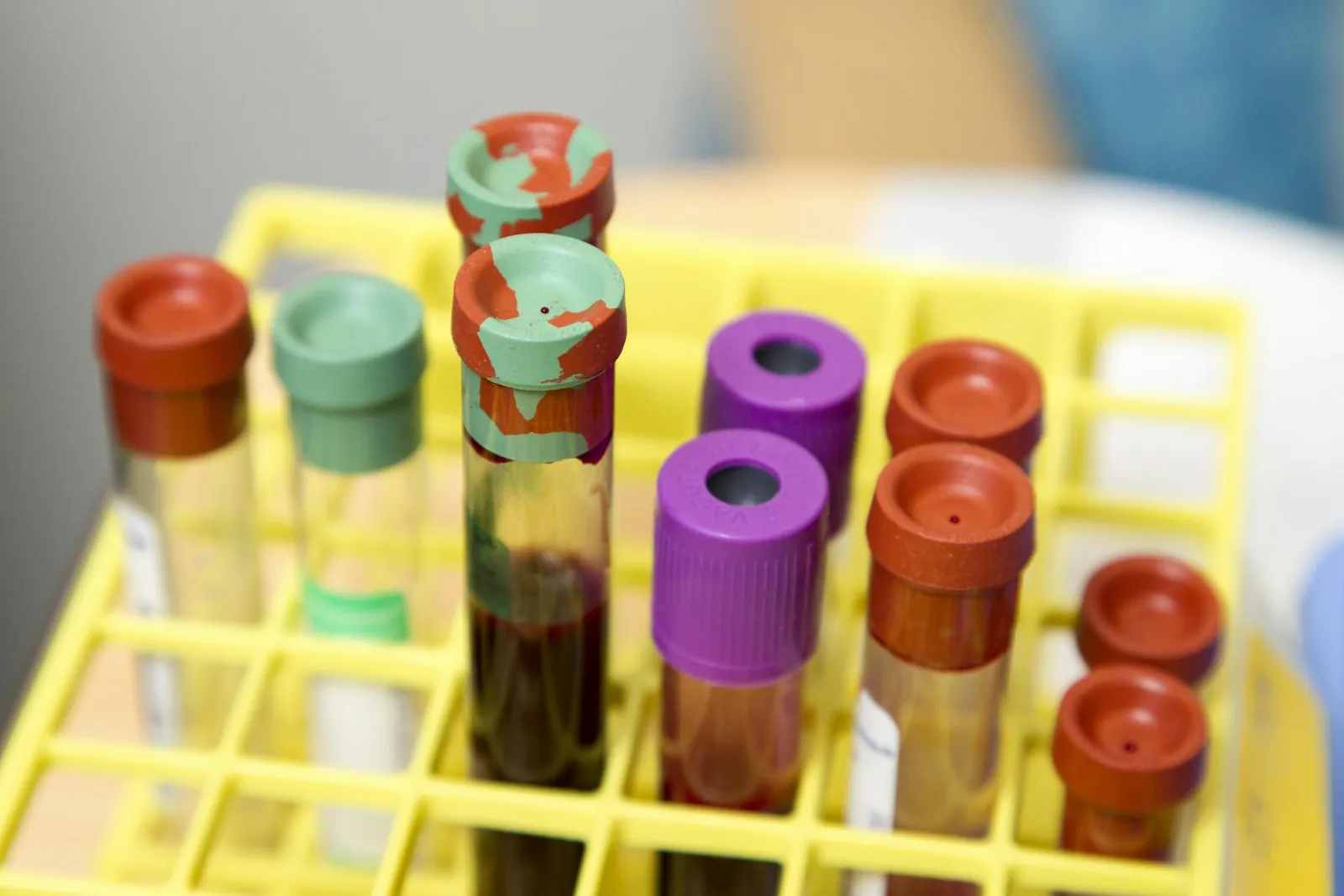 Rack of capped glass test tubes filled with dark red blood samples in a hospital lab