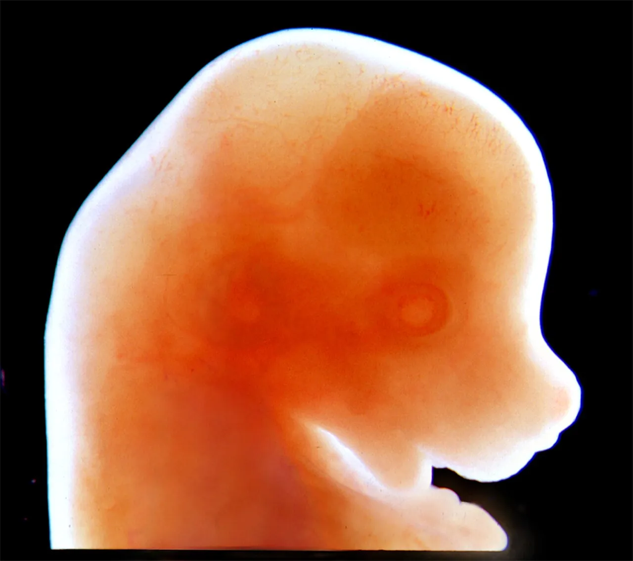 The head and face of a 13-day-old mouse embryo under a microscope