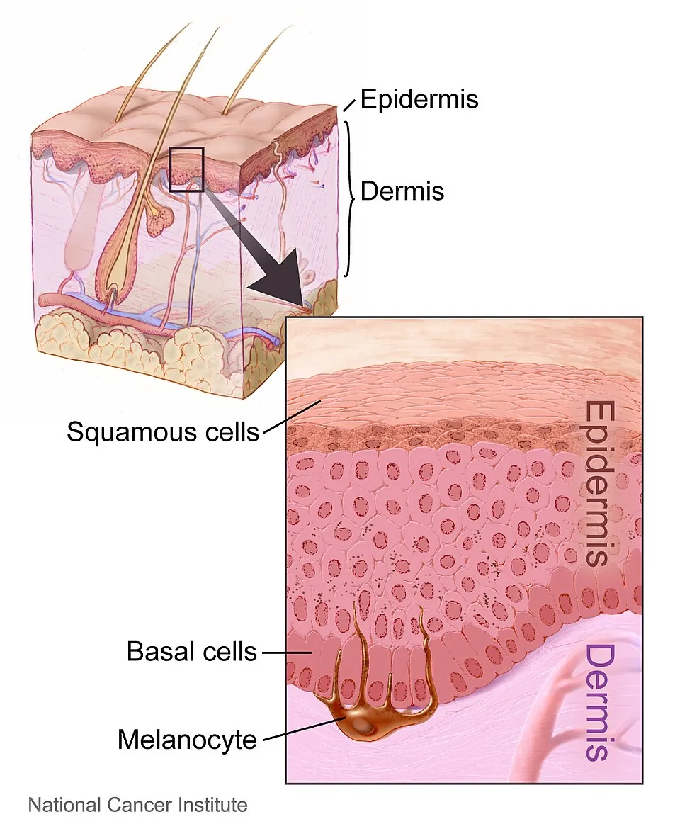 Drawing of the layers of human skin, with a close-up of the top layer showing squamous cells, basal cells and melanocytes