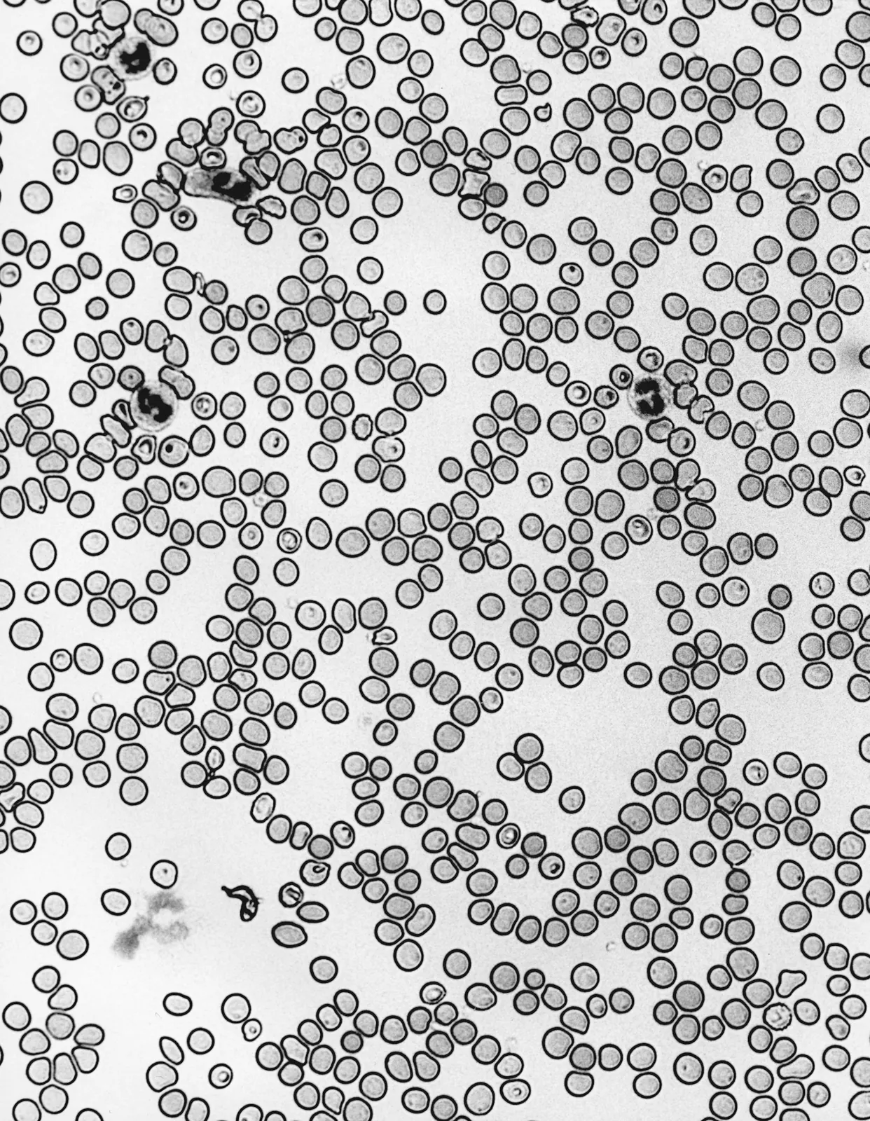 Black-and-white microscope photo of many round red blood cells