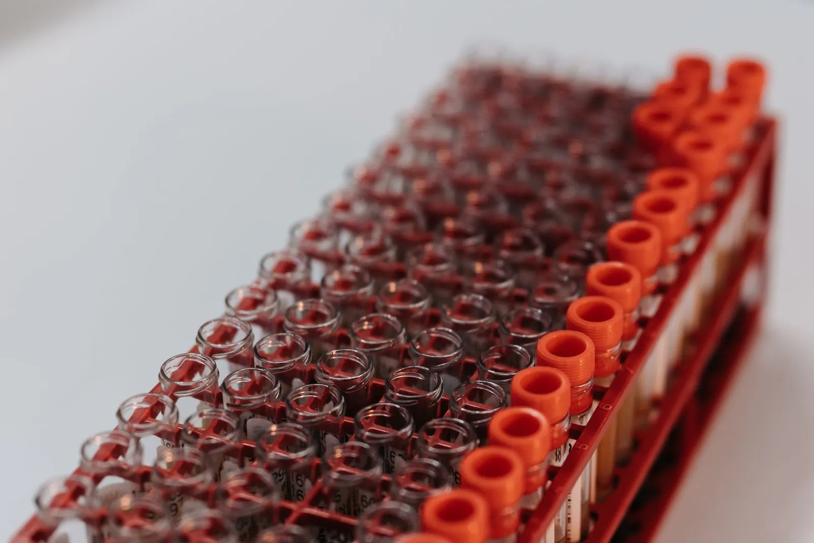 Lab test tubes lined up in a rack