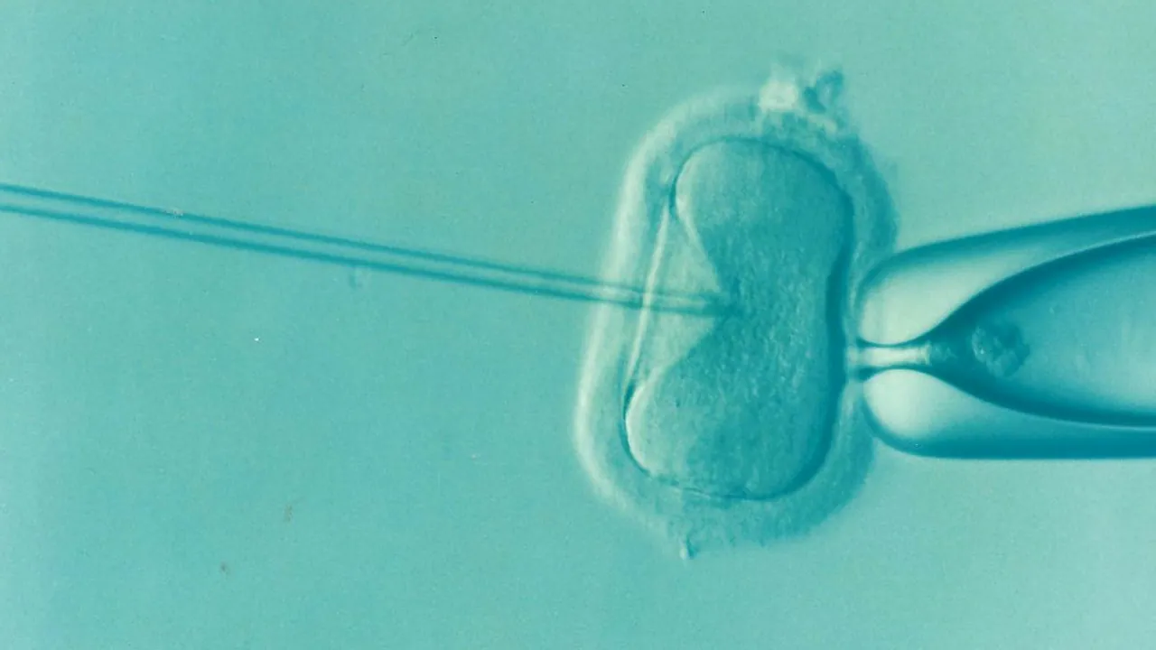 Microscope view of a fine glass needle placing one sperm inside a human egg cell