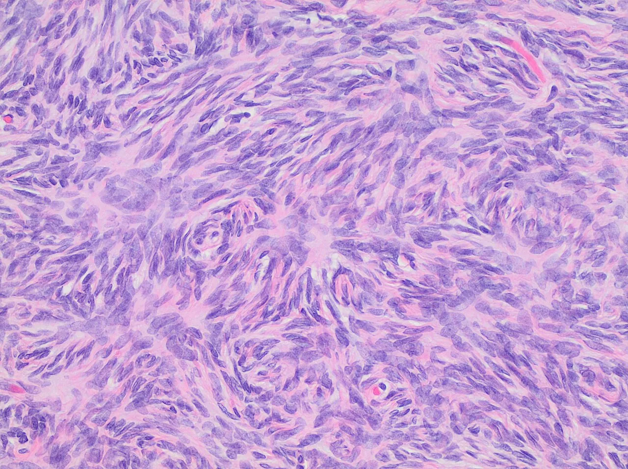 Microscope image of ovary tissue, with its cells packed in a woven pattern