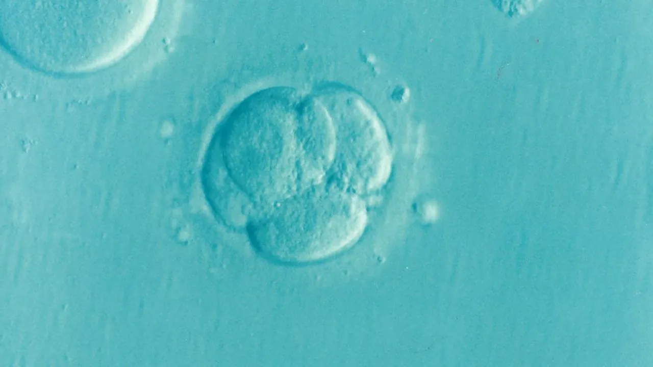 Microscope view of an early human embryo made of four cells inside a clear shell